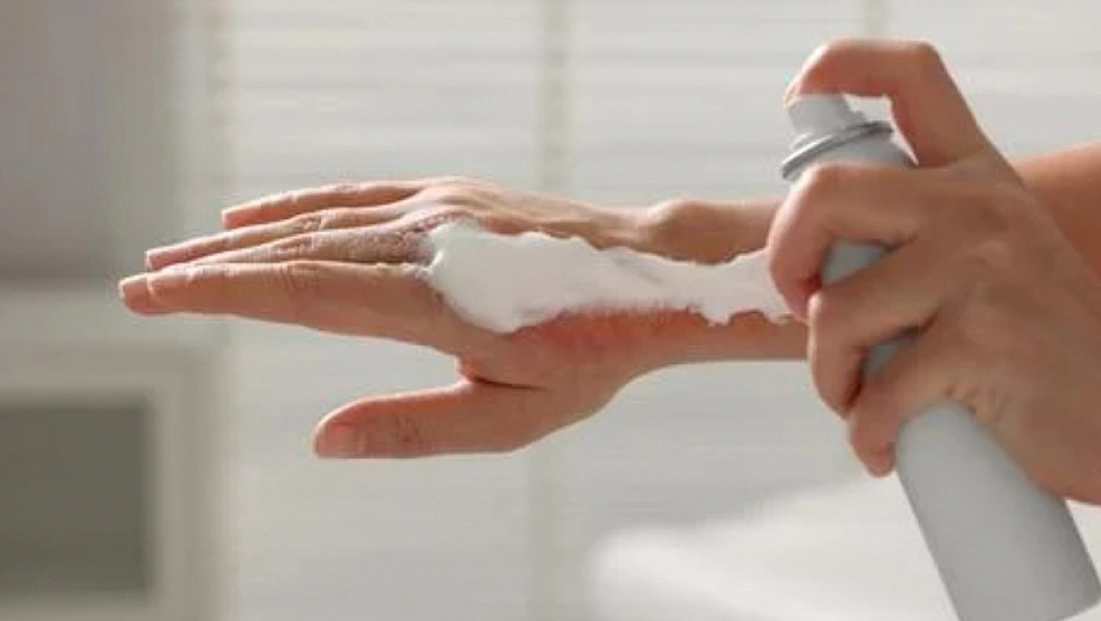 Ağır yanık tedavilerinde umut veren gelişme: Hiçbir iz kalmayacak!