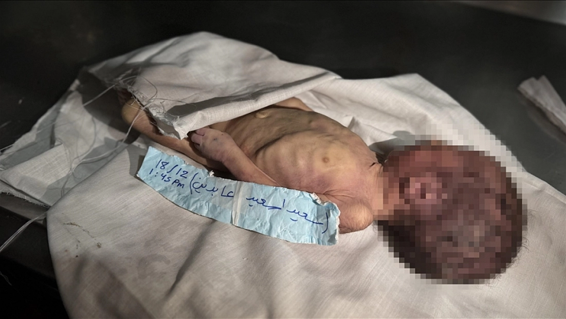 Gazze’de soğuk hava can aldı!