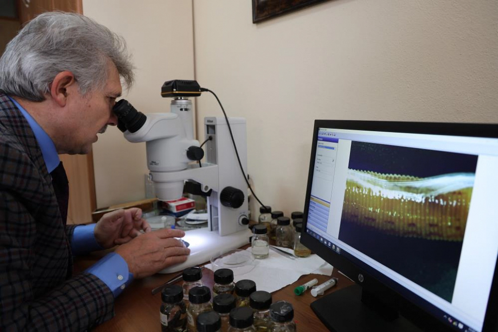 Fırat Üniversitesi'nden Büyük Keşif: Yeni Tıp Sülüğü Türü Dünya Literatüründe