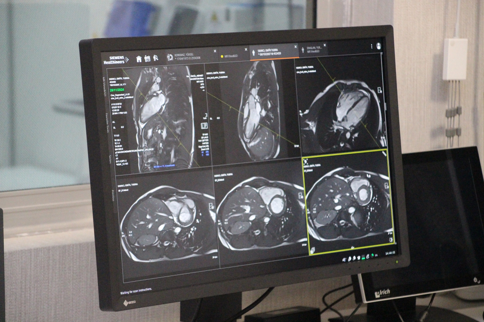 Bölgede Tek Malatya'da Bulunuyor: TÖTM, Hacettepe'ye Rakip Oldu