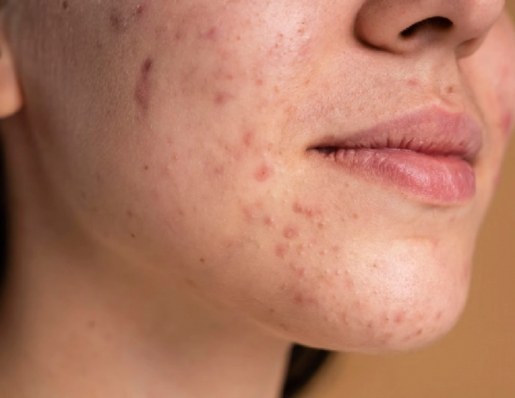 Malatyalılar dikkat! Bu belirtiler ciddi sorunların habercisi olabilir! Peki nedir bu belirtiler? İşte cevabı…