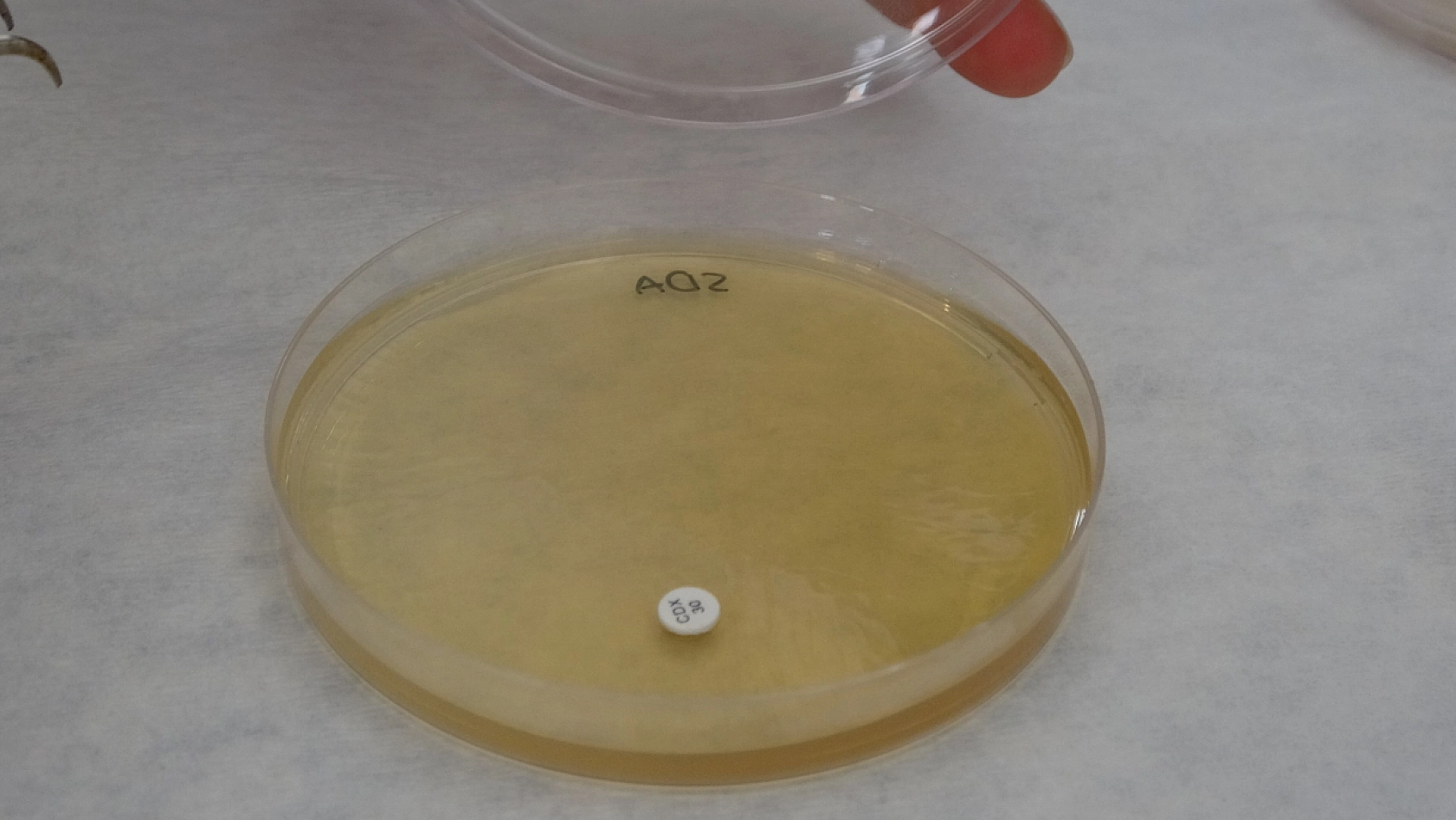 Malatya'dan Gelen Doğal Şifa: Kantaron Sarı Kantaronu Geride Bıraktı!