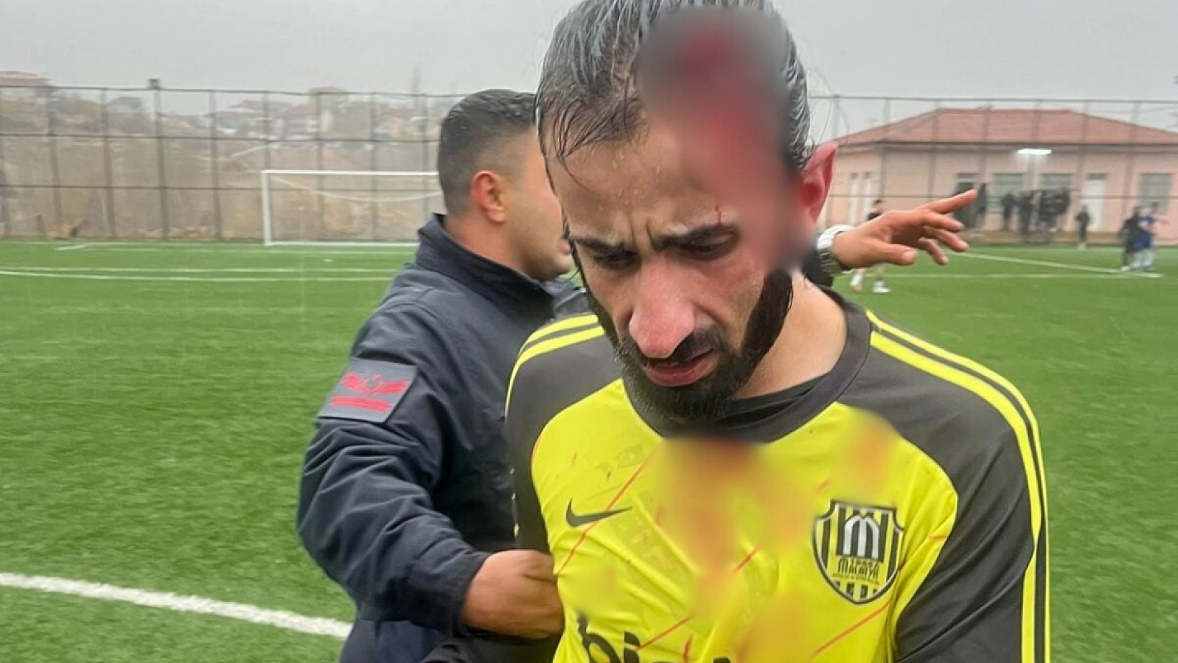Malatya'da Futbola Kan Bulaştı: Futbolcu Yaralandı, Maç Tatil Edilmedi!