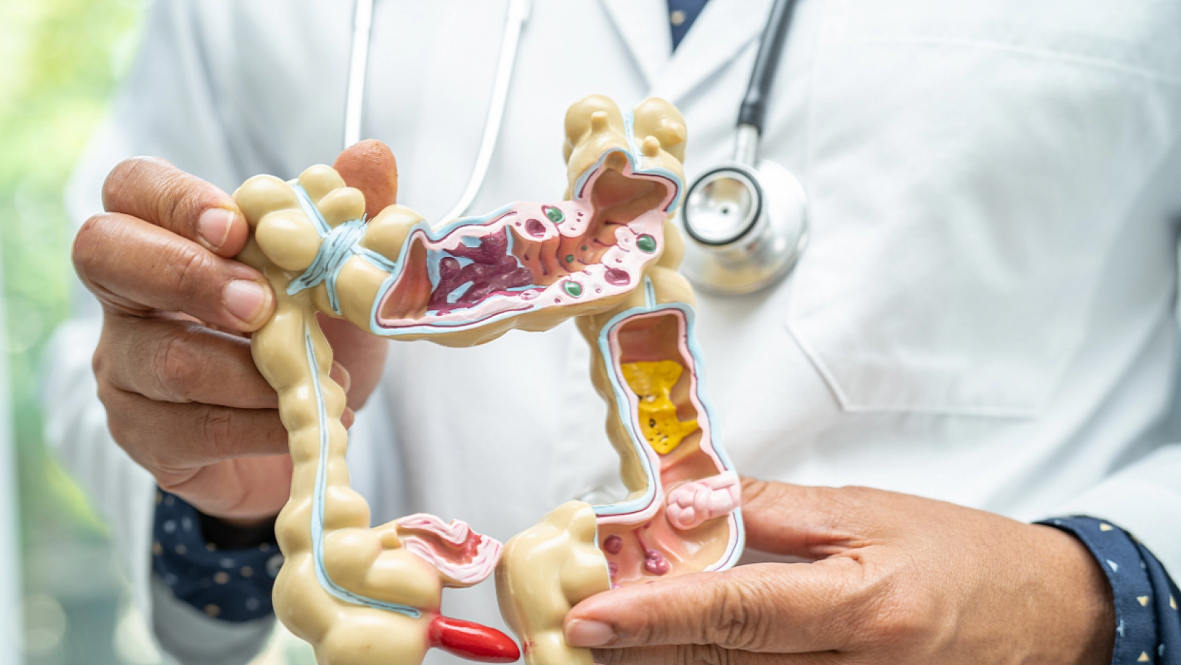 Malatya'da Kuru Erikle Sağlıklı Sindirim: Kabızlığa Kök Söktüren Doğal Çözüm!