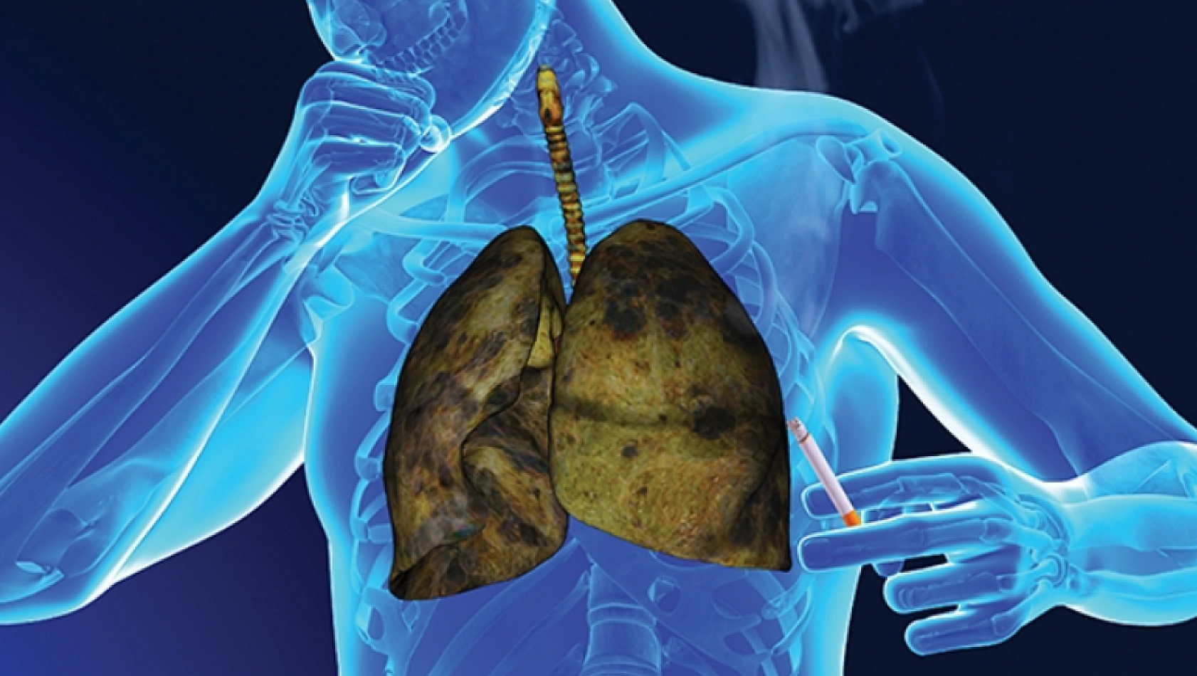 Türk Kanser Derneği'nden kritik uyarı: Erken tanı hayat kurtarıyor!