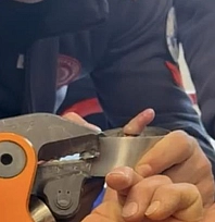 Bebeğin parmağı küllükte sıkıştı