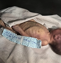 Gazze'de soğuk hava can aldı!