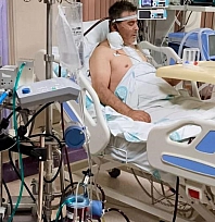 Kalp ameliyatında ECMO başarısı, bir ilk oldu