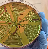 Malatya'da 122 çiğ süt örneği korkuttu! Kaynatmak yetmeyebilir!