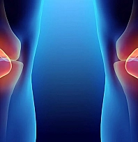 Menisküs yırtığı gençlerde de hızla artıyor