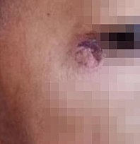 Öğrencinin yüzünde sigara söndüren temizlik görevlisi tutuklandı