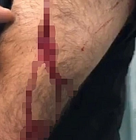 Öğretmene sokak ortasında jiletli saldırı