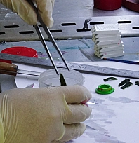 Patolojiye Giden Her Örnek Kanser mi? İşte Korkutan O Yanlış Algı!