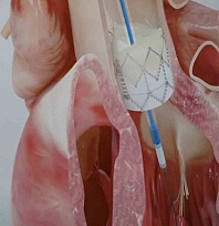 Gençlerde ani ölümün nedeni genetik faktörler olabilir!