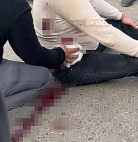 Tartışma bıçaklı kavgaya döndü: 1 yaralı