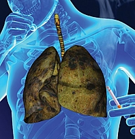 Türk Kanser Derneği'nden kritik uyarı: Erken tanı hayat kurtarıyor!