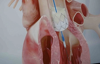 Gençlerde ani ölümün nedeni genetik faktörler olabilir!