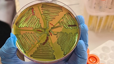 Malatya'da 122 çiğ süt örneği korkuttu! Kaynatmak yetmeyebilir!