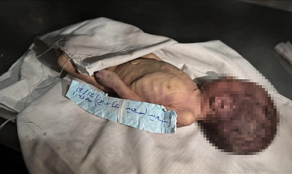 Gazze'de soğuk hava can aldı!