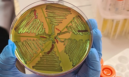 Malatya'da 122 çiğ süt örneği korkuttu! Kaynatmak yetmeyebilir!
