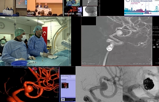 Malatya'dan dünyaya tıp dersi: Canlı yayında çifte başarı