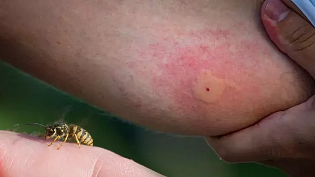 Arı sokması can aldı