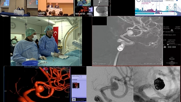 Malatya'dan dünyaya tıp dersi: Canlı yayında çifte başarı