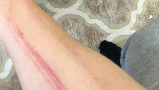 Savaştan çıkmış gibi