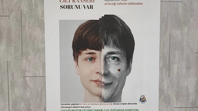 Uzman uyardı: Cilt kanseri güneşten ve genetikten besleniyor