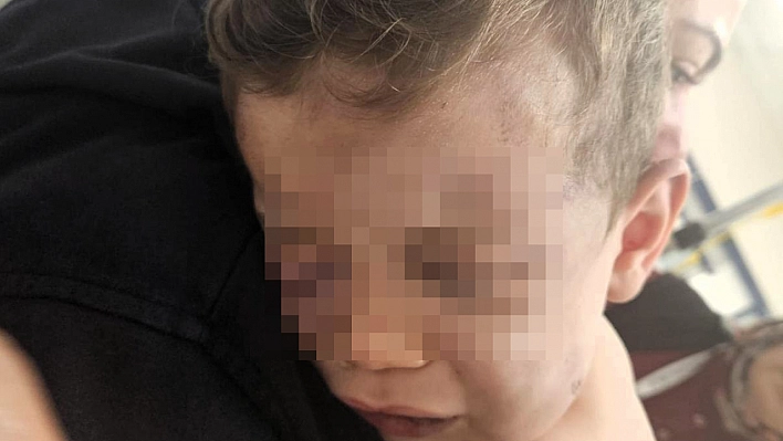 2 Yaşındaki Bebek Feci Şekilde Dövüldü