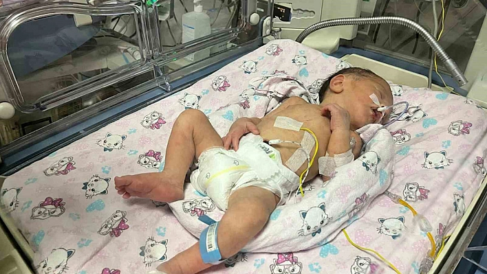 Adana'da annesi kazada ölen bebek, hayata tutundu