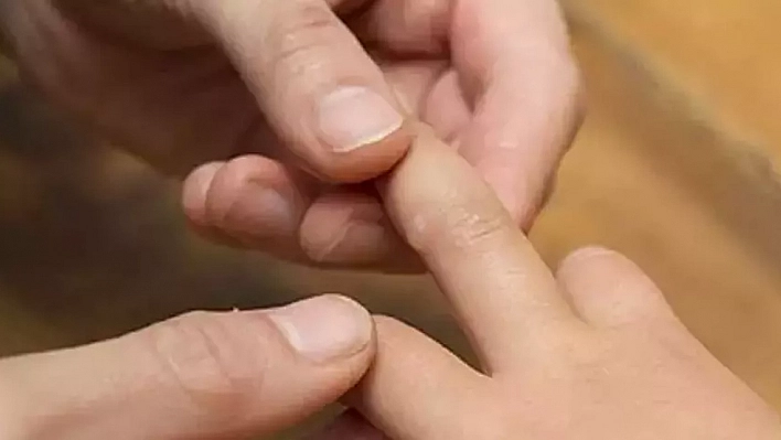 Uzmanı uyardı: Bu hastalığa dikkat|Çocuklar arasında çok hızlı yayılıyor…
