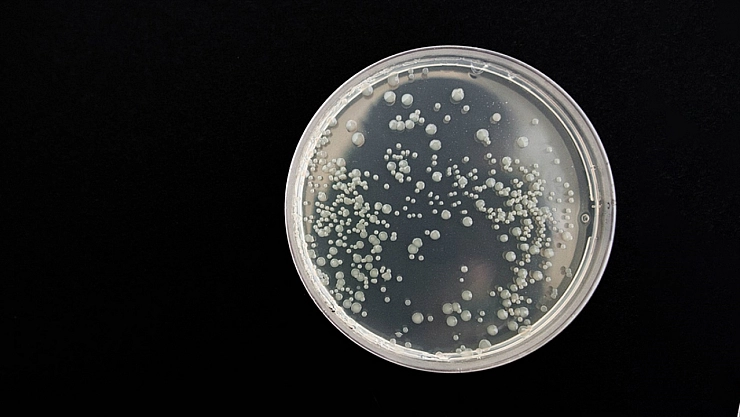 Bakteriler bakın en çok neden besleniyor?