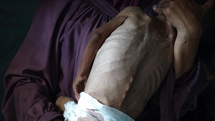 Gazze'de son 24 saatte 1'i çocuk 6 kişi açlıktan hayatını kaybetti