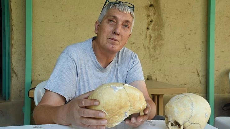 Kafataslarının şekli değiştirilmiş