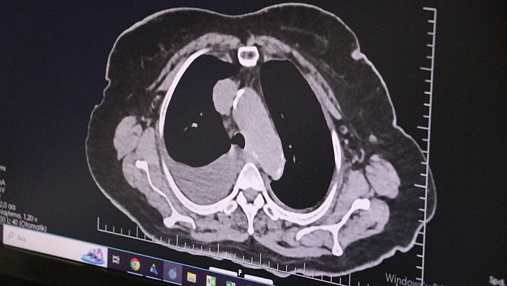 Kalp sağlığında genç kuşak alarmı