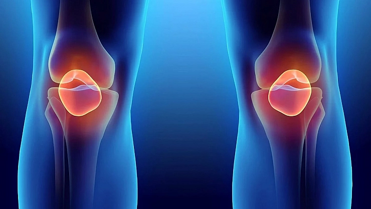 Menisküs yırtığı gençlerde de hızla artıyor