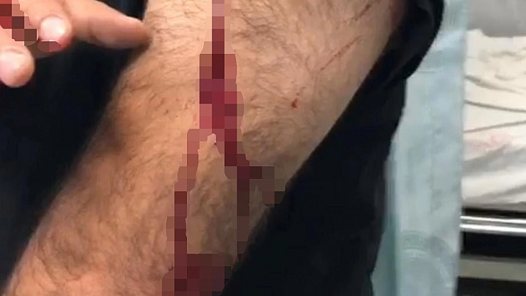 Öğretmene sokak ortasında jiletli saldırı