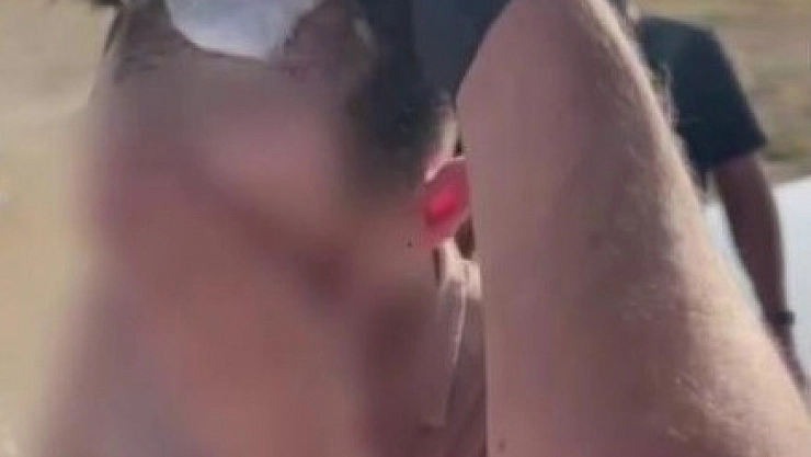 Protez Saçtan Uyuşturucu Çıktı