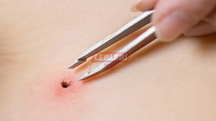 Sağlık Bakanlığından Kene Açıklaması: Mücadele Sürüyor