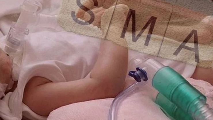 SMA ilacına geri ödeme müjdesi: Bir ilaç daha listeye alındı, hastaneler temin edecek…!