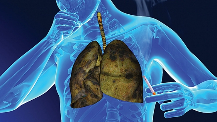 Türk Kanser Derneği'nden kritik uyarı: Erken tanı hayat kurtarıyor!