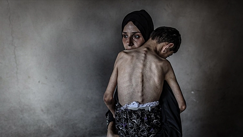 Gazze'de bir ayda 185 kişi açlıktan öldü