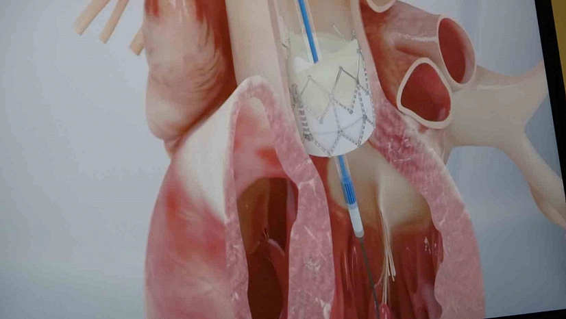 Prof. Dr. Pekdemir'den kalp uyarısı: Nedeni genetik olabilir