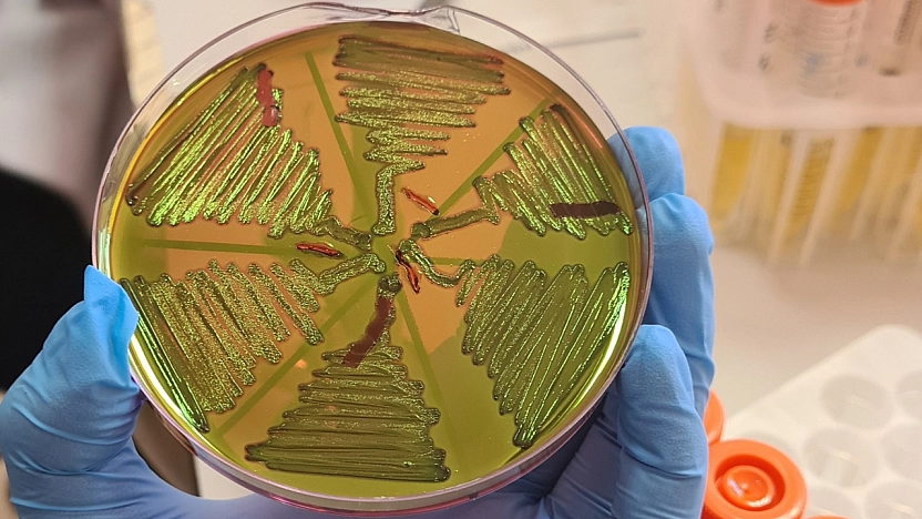 Malatya'da 122 çiğ süt örneği korkuttu! Kaynatmak yetmeyebilir!