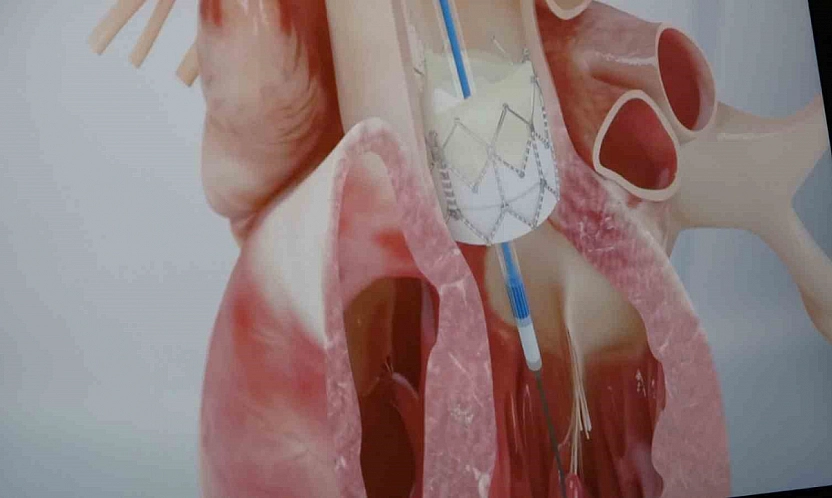 Gençlerde ani ölümün nedeni genetik faktörler olabilir!