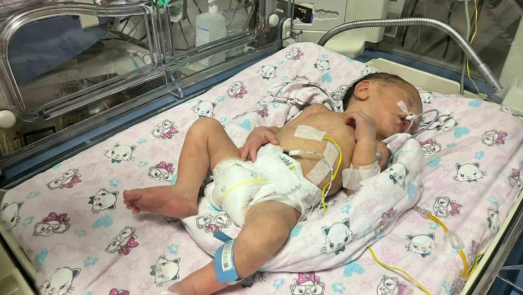 Adana'da annesi kazada ölen bebek, hayata tutundu